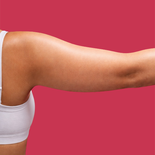 Arm Lift Cost in Turkey