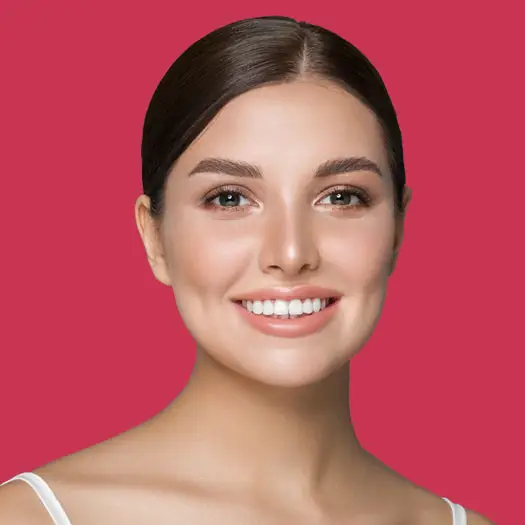 Emax Laminate Veneers